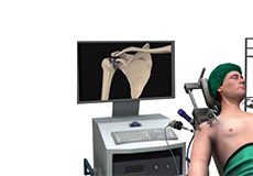 Minimally Invasive Shoulder Joint Replacement